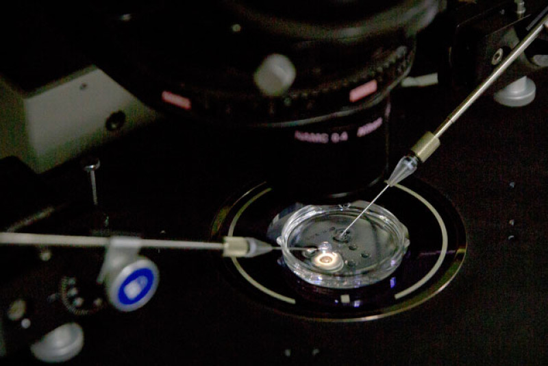 Procedimiento. Un embrión recibe una pequeña dosis de proteína Cas9 y sgRNA PCSK9 en un microscopio de inyección de esperma en un laboratorio en Shenzhen, en la provincia de Guangdong, sur de China.