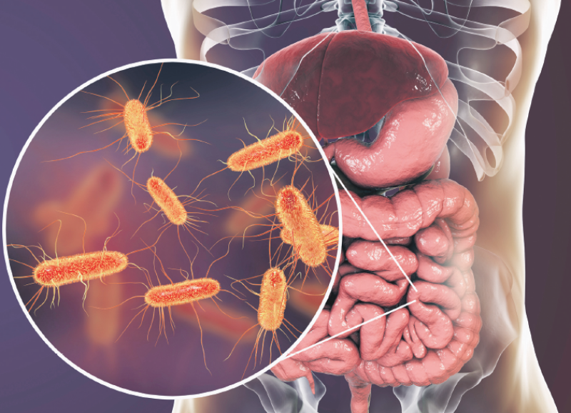 Múltiples bacterias y afecciones podrían alterar el funcionamiento del intestino delgado.

ISTOCK Y CORTESÍA DE LA EXPERTA