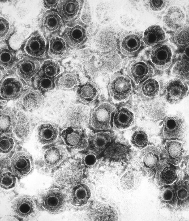 Demuestran que el virus Herpes Simplex Tipo 1 puede salir del interior de células a las que infecta. Europa Press.
