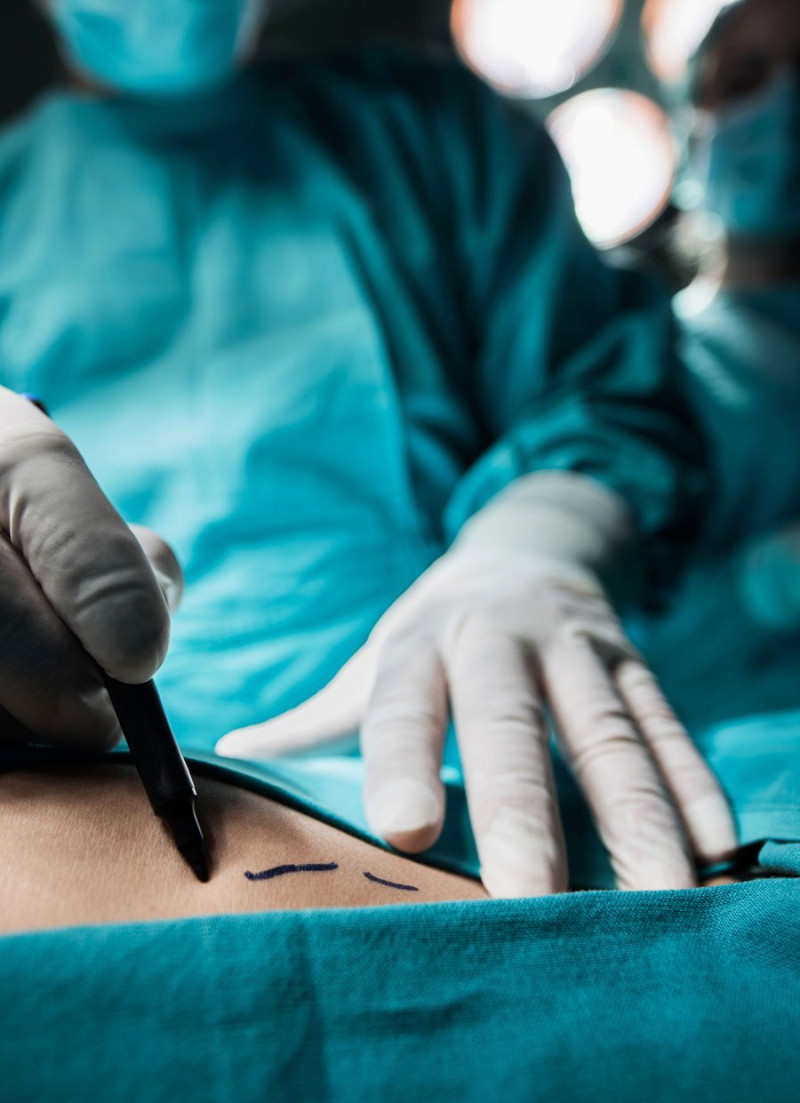 A los servicios de cirugía plástica, estética y reconstructiva del país llegan con frecuencia casos de pacientes con lesiones complicadas en glúteos y otras partes del cuerpo.