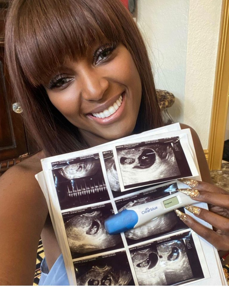 Amara la Negra compartió en sus redes sociales una fotografía junto a una sonografía y una prueba de embarazo.
