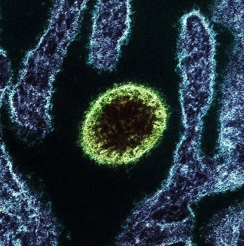 Virus Nipah. Foto: Europa press.