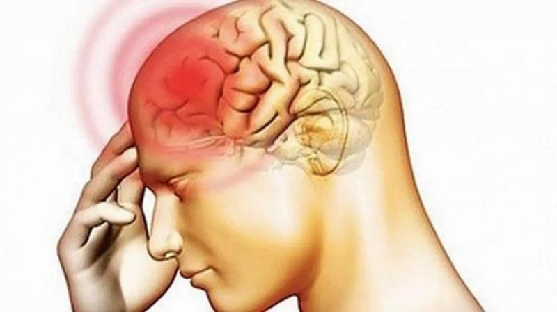 Meningitis/ Imagen fuente externa