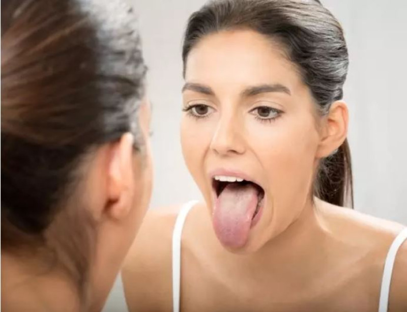 Mujer mirando la lengua en un espejo.