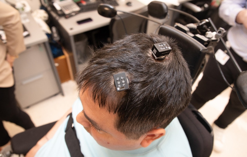A Keith Thomas, que vive con parálisis, le implantaron cinco microchips diminutos en su cerebro, formando una parte crítica de un "bypass neural doble" primero en su tipo que utiliza inteligencia artificial para decodificar y traducir sus pensamientos en acción