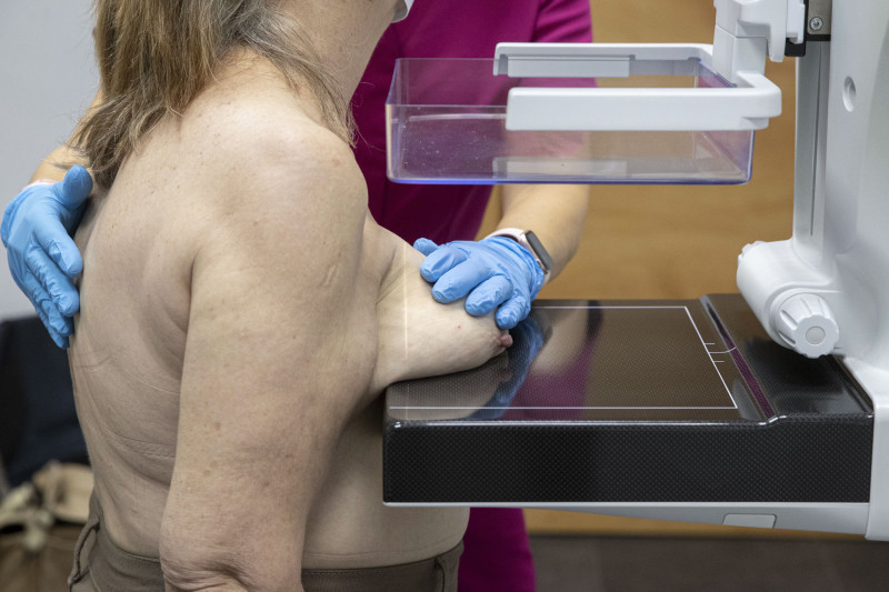Una enfermera de la Asociación Contra el Cáncer realiza una mamografía a una mujer en la sede de la Asociación de Murcia (España)