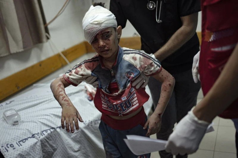 Un niño palestino, herido en un bombardeo israelí contra la Franja de Gaza, es trasladado a un hospital de Jan Yunis el sábado 21 de octubre de 2023.
