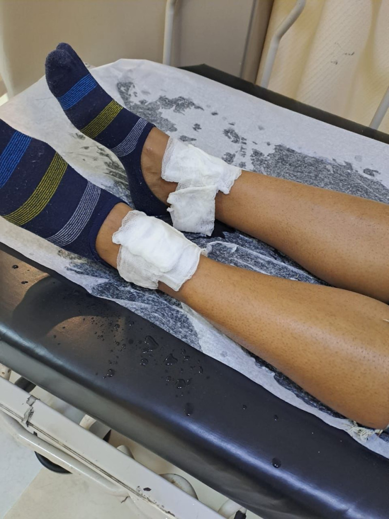 Fotografía muestras pies de estudiante de la Universidad Dominicana O&M afectada por explosión.
