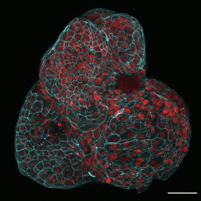 Esta imagen de microscopio facilitada por los investigadores en marzo de 2024 muestra un organoide pulmonar creado a partir de células recogidas del líquido amniótico.