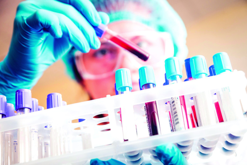 Las pruebas de laboratorio son fundamentales para ayudar al médico a establecer el diagnóstico de una enfermedad y su tratamiento.