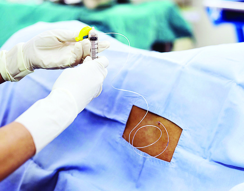 En el país hay 14 anestesiólogos por cada 100 mil habitantes.