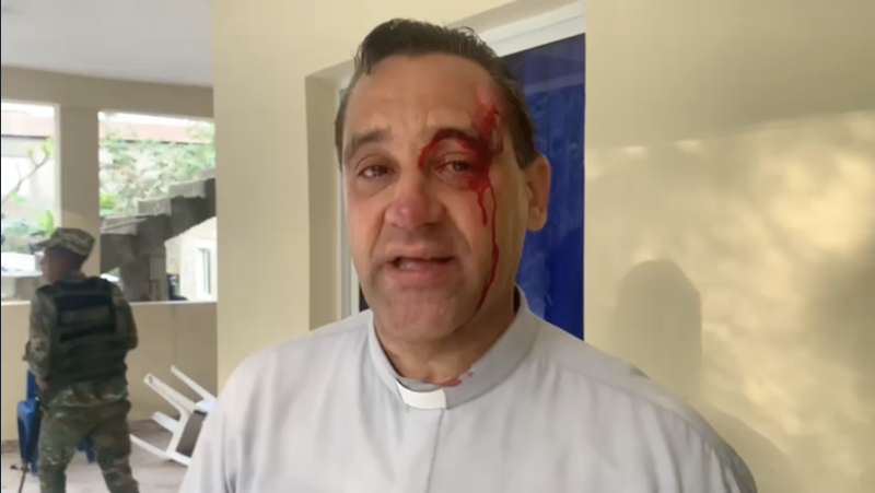 El sacerdote Johnny  Durán resultó herido durante la protesta de comunitarios.