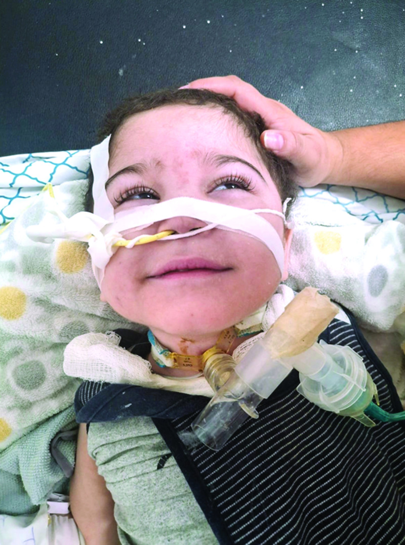 El pequeño Nicolás Viloria Mejía, de 2 años, en dura lucha por su vida.