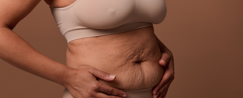 Es fundamental esperar al menos ocho meses después de finalizar la lactancia para que el cuerpo estabilice hormonas y peso.