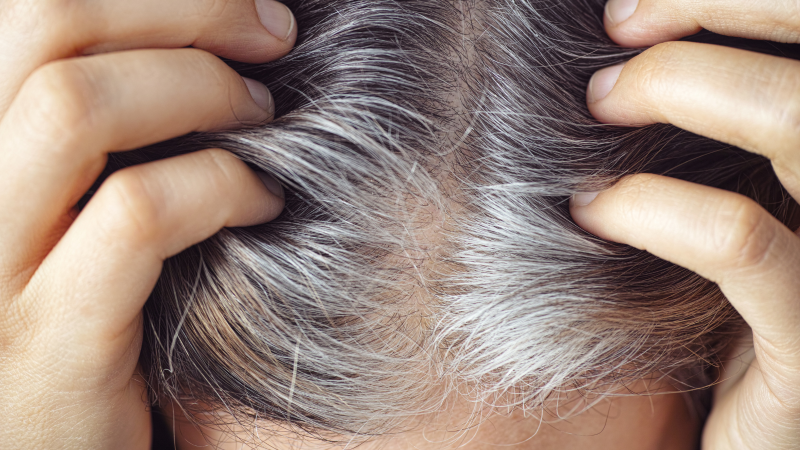 Una mala alimentación es la primera causa de la aparición de canas.