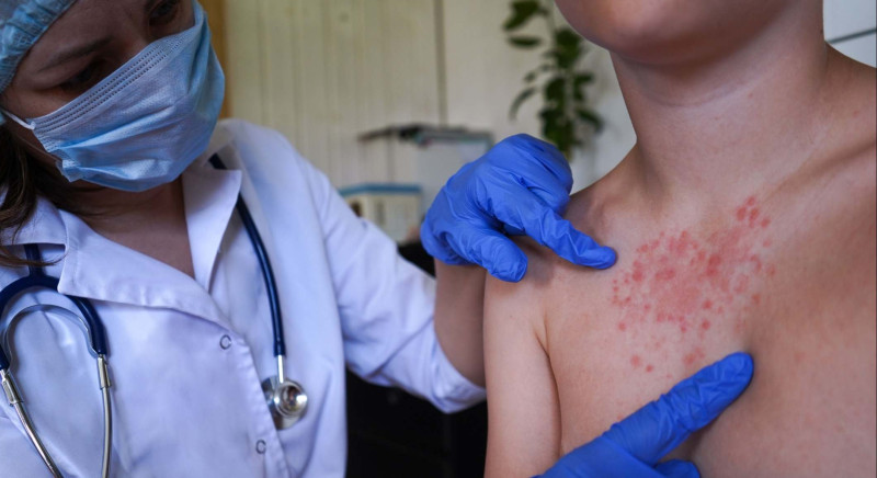 Sociedad de Infectología recomienda aumentar los niveles de vacunación entre los niños.