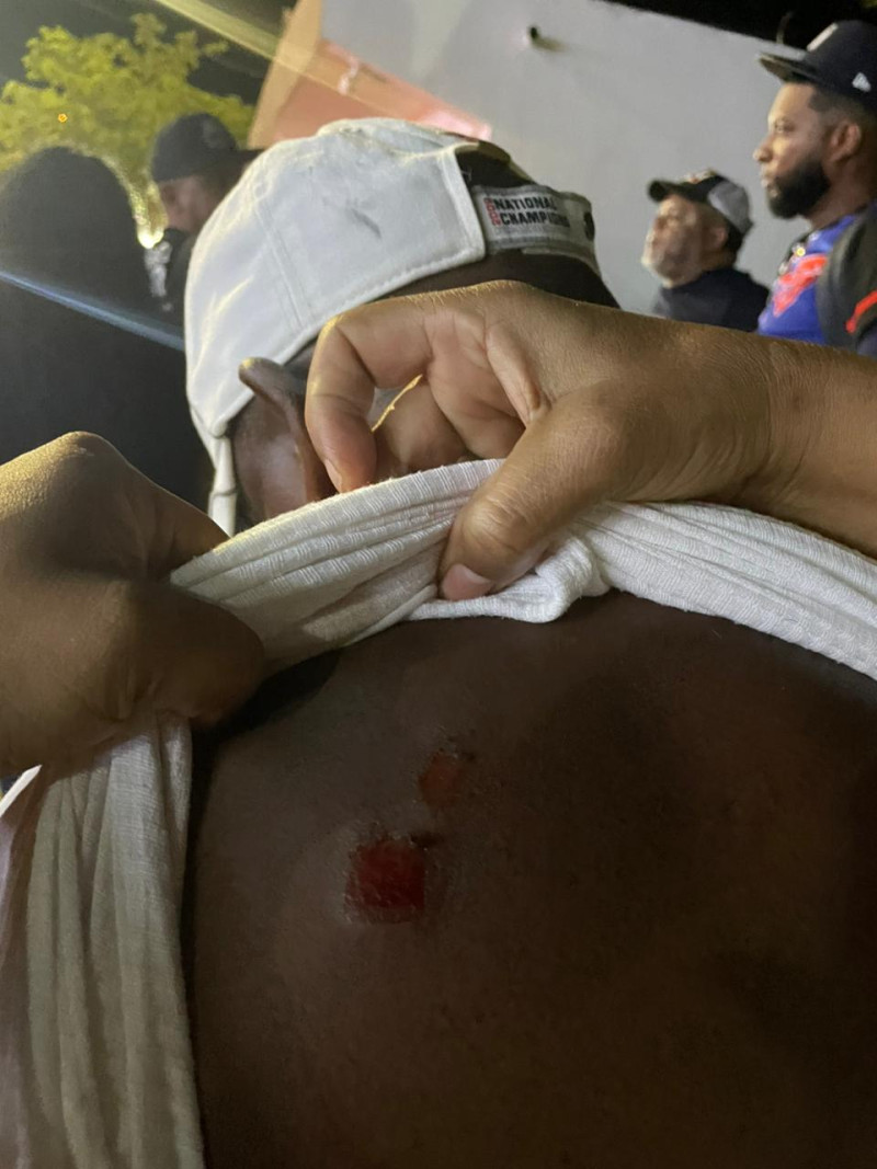 Hombre herido en Villa Vásquez, Montecristi, tras tensión policial la noche del domingo.