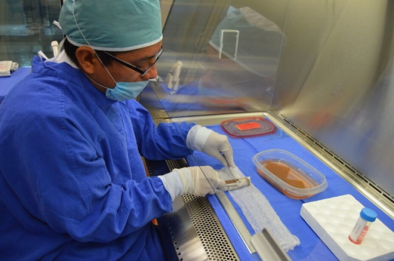 El banco de piel reforzará la atención que se brinda a pacientes con quemaduras de grandes extensiones.