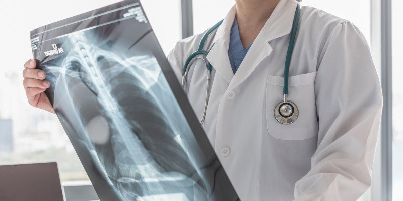 La hipertensión arterial pulmonar afecta mayormente a mujeres.