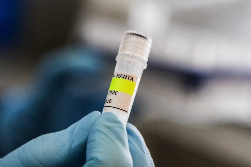 Esta fotografía, difundida por el Ministerio de Salud de Argentina, muestra a un científico del Instituto Malbrán sosteniendo un recipiente utilizado para diagnosticar el hantavirus andino.