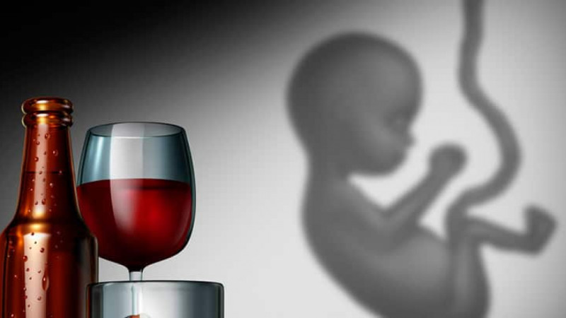 El Síndrome Alcohólico Fetal (SAF) se transmite a los bebés por el consumo de alcohol durante el embarazo.
