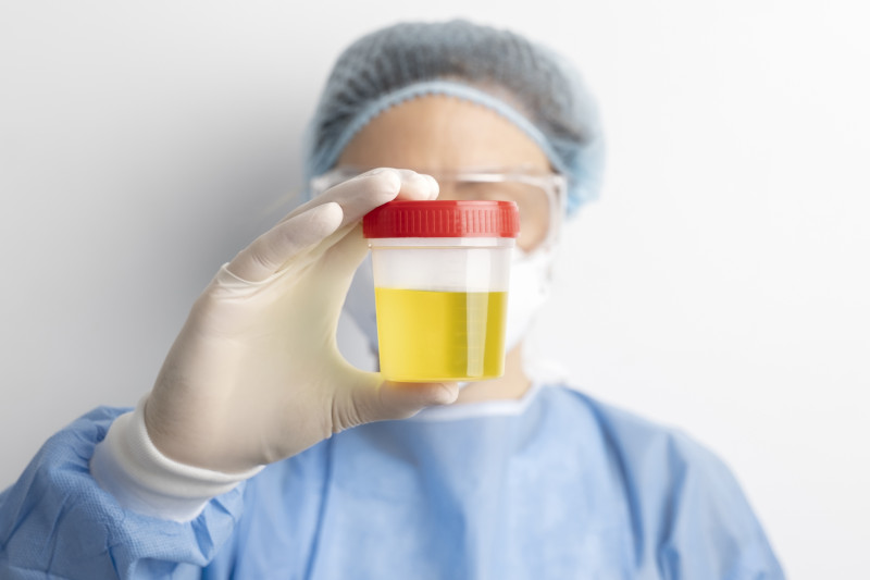Los análisis de orina convencionales permiten identificar la bacteria causante de una infección urinaria al cabo de 36 horas. Foto: Magnific.