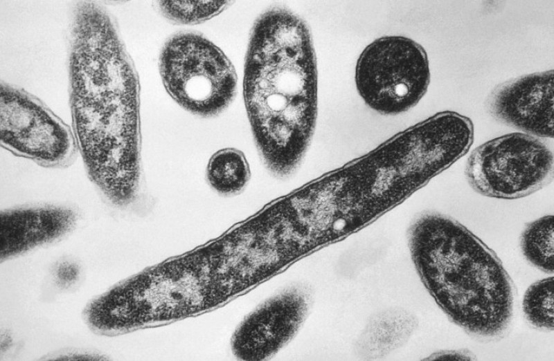 Esta imagen de microscopio electrónico de 1978 muestra la bacteria Legionella pneumophila, responsable de la enfermedad neumónica conocida como legionelosis.